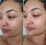 Charger l'image dans la galerie, Masque à l'argile + pinceau applicateur GRATUIT (120g) - HeyBud