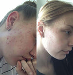 Charger l'image dans la galerie, Masque à l'argile + pinceau applicateur GRATUIT (120g) - HeyBud